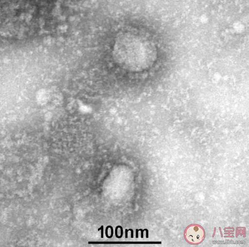 新型冠状病毒肺炎全国统一最新出院标准是什么 新型肺炎什么程度可以出院