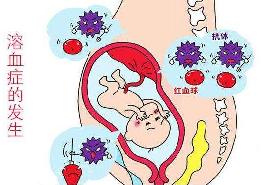 妈妈什么血型比较容易生出溶血症孩子 孩子溶血症是什么原因导致的