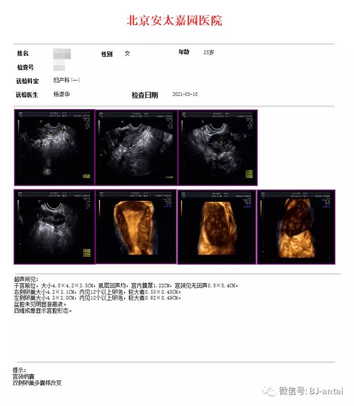 北京安太医院治疗不孕不育好吗 签约治疗有保障