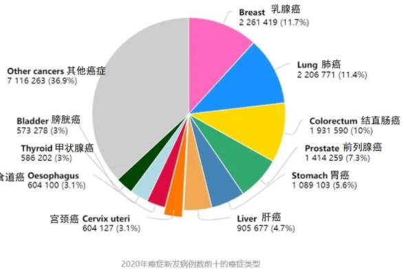 乳腺癌已成全球最常见癌症 什么人最容易得乳腺癌