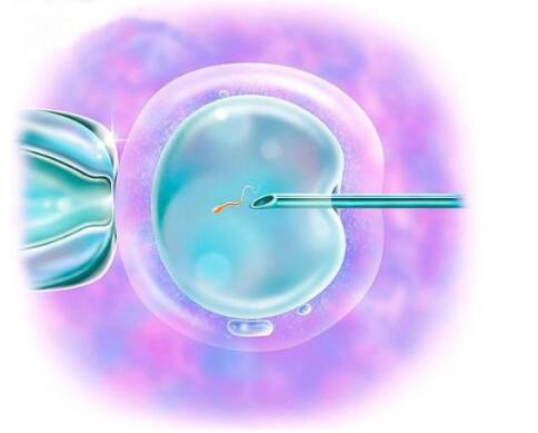 试管婴儿胎移植后能有性生活吗 胎移植后性生活能提高种植率吗2022