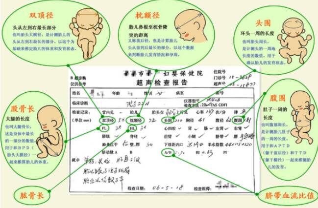 如何快速读懂B超检查单 B超单各字母的含义