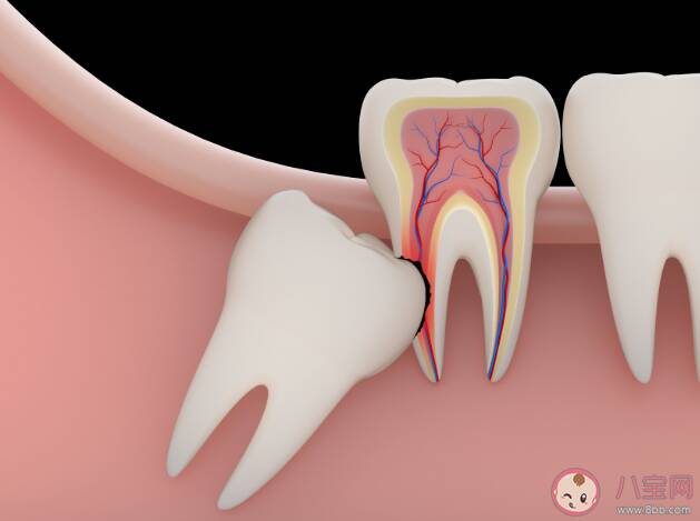智齿每个人都会长吗 智齿不痛要拔吗