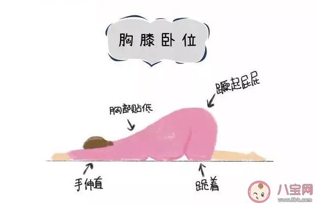 胎位不正臀位怎么办 胎位不正臀位怎么调整过来