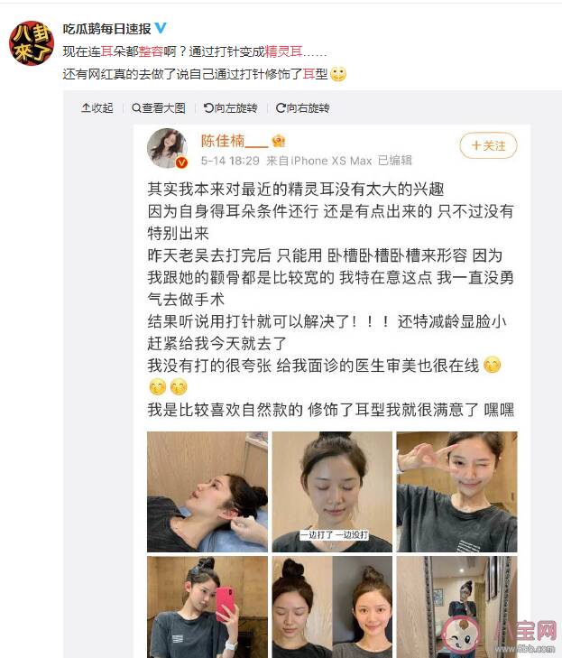 精灵耳是什么样的 为什么精灵耳能如此受欢迎