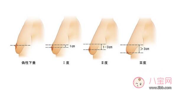 妈妈断奶后如何丰胸 胸部下垂拯救办法