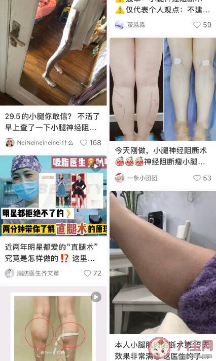 小腿肌肉阻断术瘦腿原理是什么 小腿肌肉阻断术有什么危害