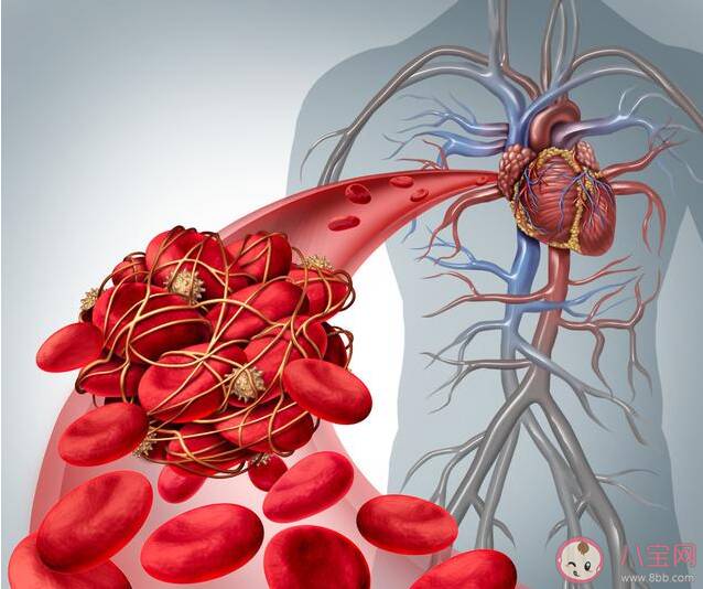 晚上睡觉什么表现是血管堵塞了 血管堵塞对身体有什么危害