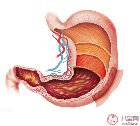 萎缩性胃炎是胃缩小了吗 萎缩性胃炎会癌变吗