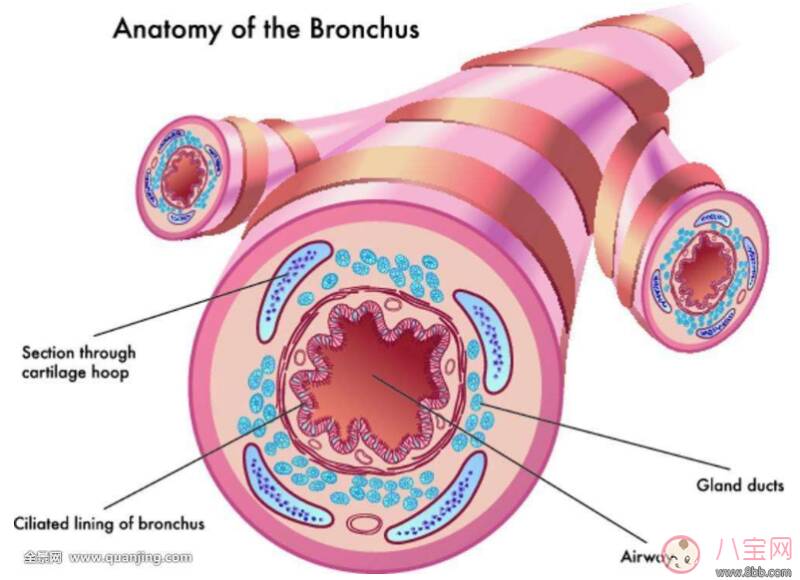 孩子总是咳嗽会变成支气管炎吗 怎么预防支气管炎