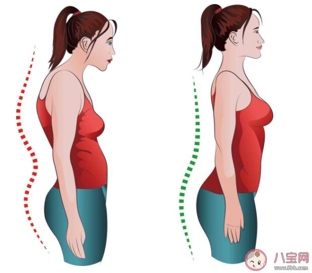 经常驼背脸会变大吗 四个方法把背挺起来