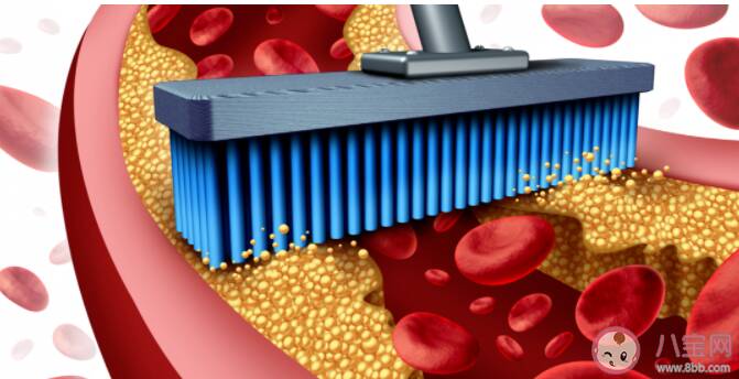 让血管变堵的5大罪魁祸首 血管堵塞会带来什么影响