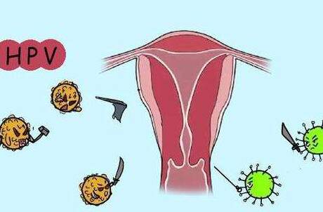 女性尖锐湿疣可以怀孕吗 女性尖锐湿疣的传播方式是什么