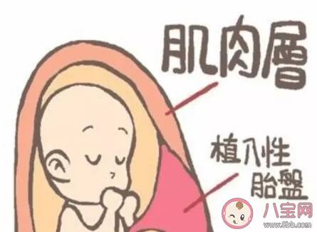 剖宫产瘢痕妊娠手术的方案 剖宫产瘢痕妊娠怎么治疗