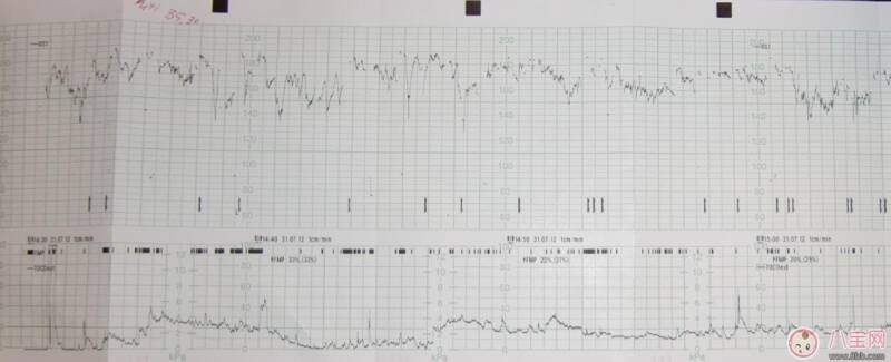 孕检胎心率12周多少算正常 胎心率过低会怎么样