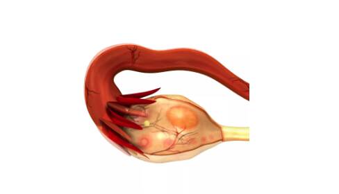 促排卵会导致卵巢早衰吗 什么是促排卵