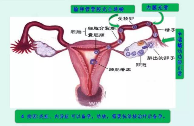 输卵管通而不畅可以备孕吗 输卵管通而不畅能怀孕吗