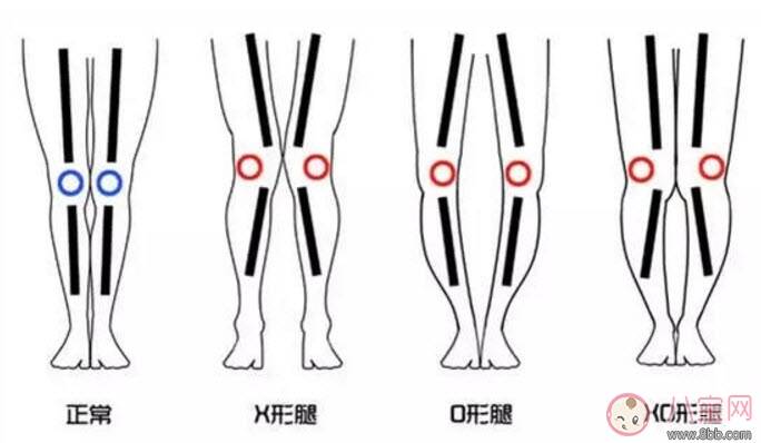 怎样让宝宝有大长腿 宝宝腿型注意事项