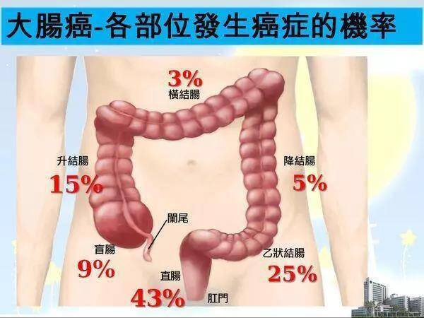 深圳天元中医肛肠医院:关于便秘你需要知道的9大真相