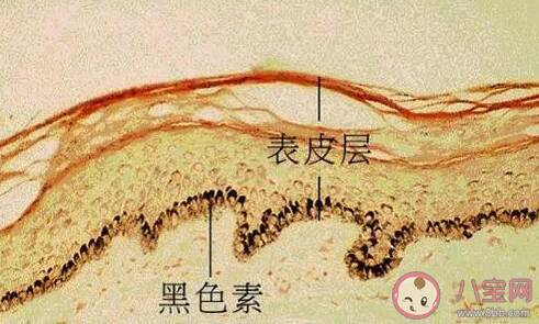 生活中患有白癜风会传染吗 白癜风会不会传染给别人