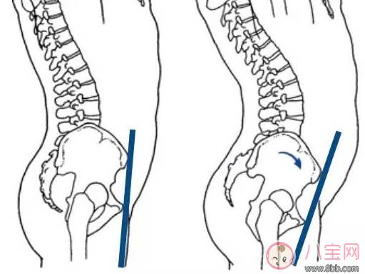 柯基臀是骨盆前倾吗 李菲儿的柯基臀是怎么练成的