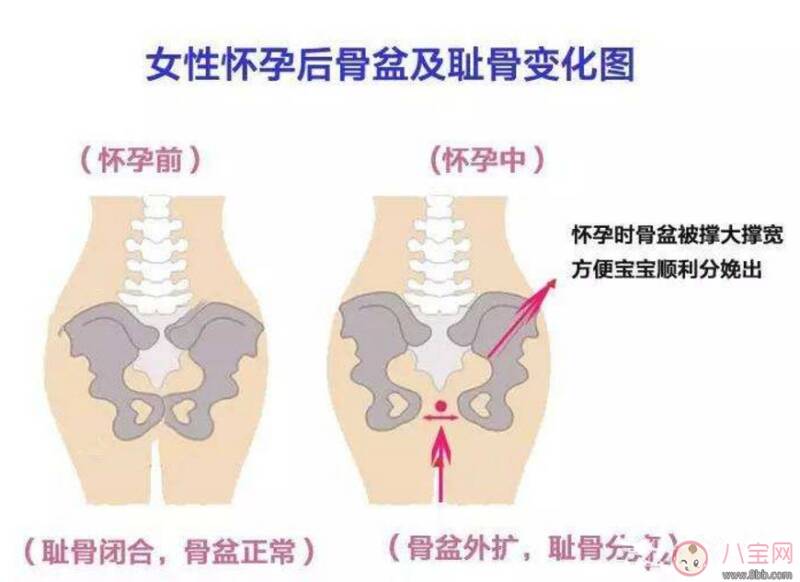 耻骨痛怎么办 孕晚期如何缓解耻骨痛