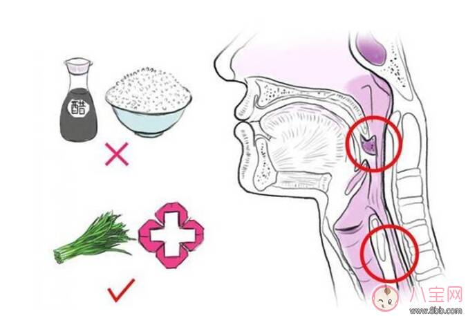 宝宝吃鱼卡鱼刺 急着自己去夹刺就大错特错了