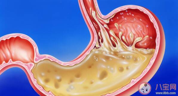 饭后经常反酸是怎么回事 反酸烧心吃花生管用吗