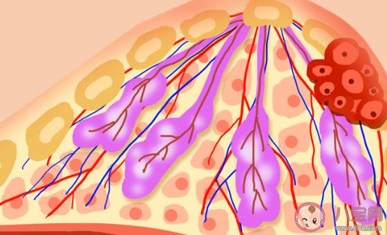 查出乳腺小叶增生会癌变吗 一分钟乳房自检方法