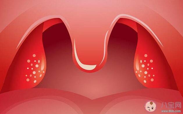 摘除扁桃体对孩子身体有影响吗 扁桃体摘除后抗感染能力会不会下降